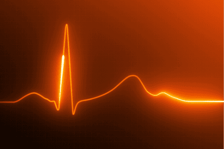 Heart Rate Variability